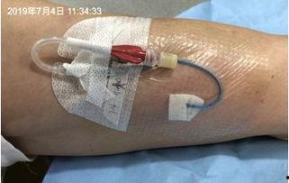 自制成人护胃腰带视频